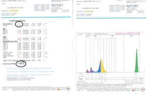 Lipid profile 2